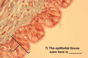 Quiz Epithelial Tissues Histology Atlas For Anatomy And Physiology