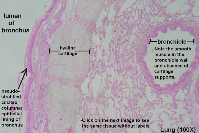 Bronchi And Bronchioles Tutorial Histology Atlas For Anatomy And