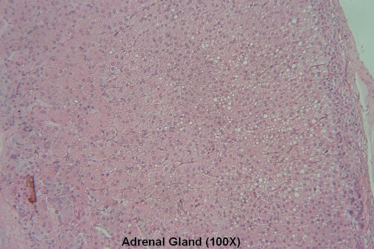 Adrenal Gland Tutorial Histology Atlas For Anatomy And Physiology