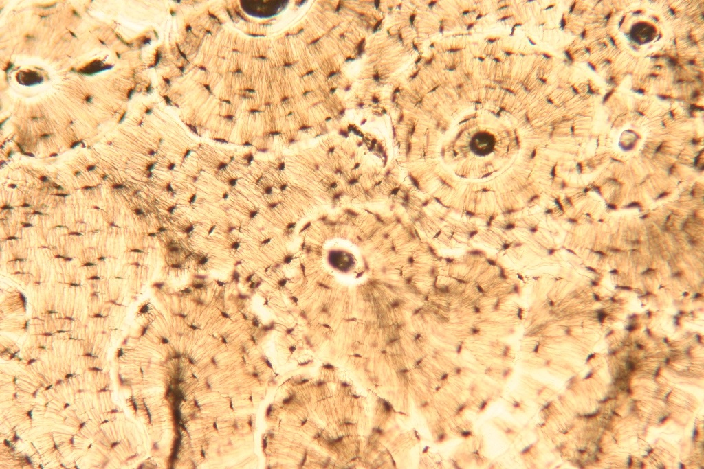 Костная ткань под микроскопом рисунок