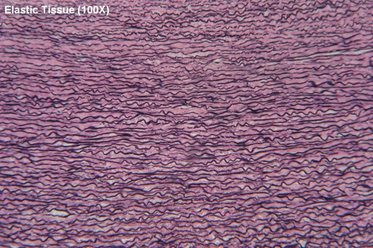 Elastic Tissue Tutorial Histology Atlas for Anatomy and Physiology