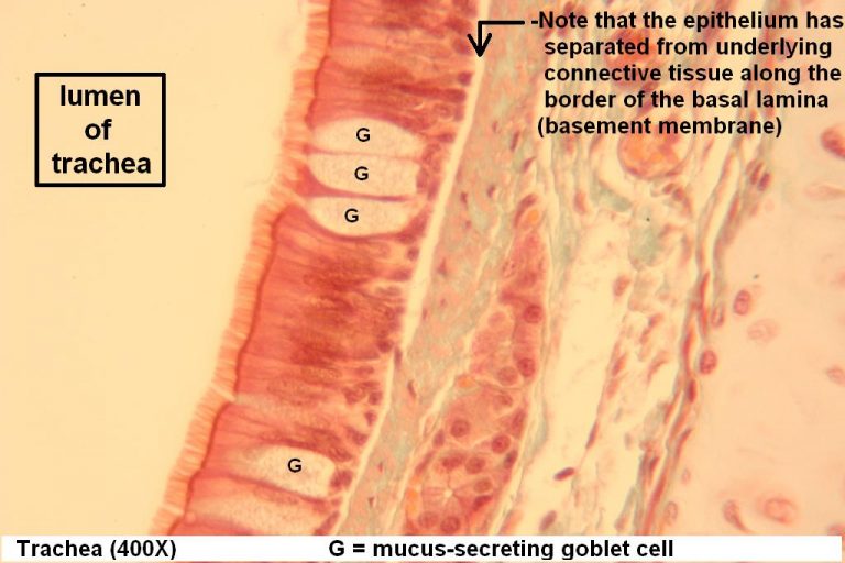 Pseudostratified Ciliated Columnar – Tutorial – Histology Atlas for ...