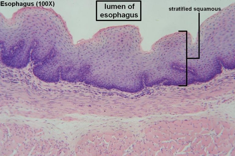 Stratified Squamous – Tutorial – Histology Atlas for Anatomy and Physiology