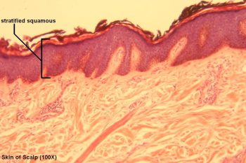 Stratified Squamous – Tutorial – Histology Atlas for Anatomy and Physiology