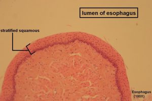 Stratified Squamous – Tutorial – Histology Atlas for Anatomy and Physiology