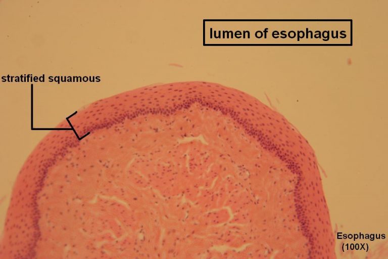 Stratified Squamous – Tutorial – Histology Atlas for Anatomy and Physiology