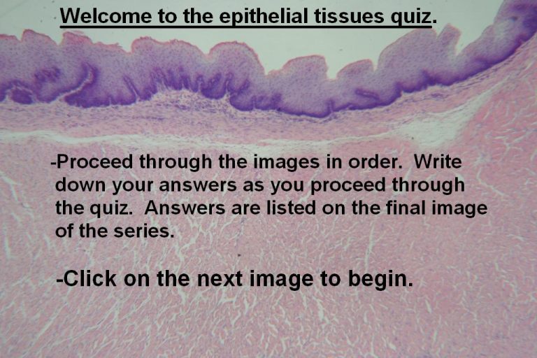 Quiz Epithelial Tissues Histology Atlas for Anatomy and Physiology