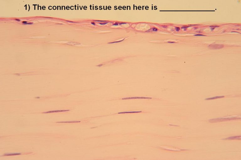 Quiz – Connective Tissues – Histology Atlas For Anatomy And Physiology