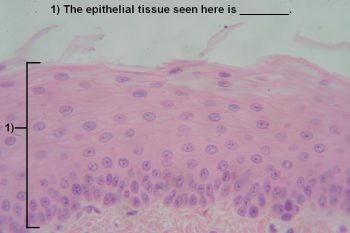 Quiz – Epithelial Tissues – Histology Atlas For Anatomy And Physiology