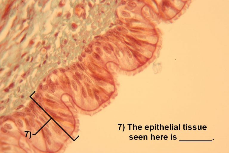 Quiz – Epithelial Tissues – Histology Atlas For Anatomy And Physiology