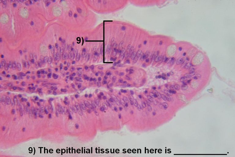 Quiz – Epithelial Tissues – Histology Atlas For Anatomy And Physiology