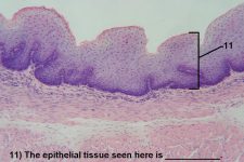 Quiz – Epithelial Tissues – Histology Atlas for Anatomy and Physiology