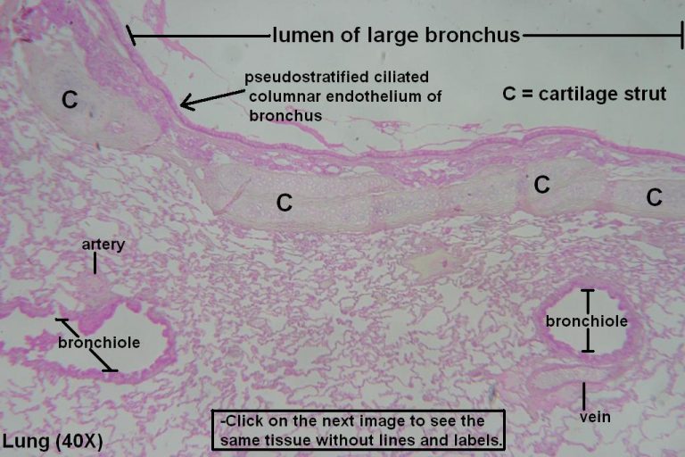 Bronchi And Bronchioles Tutorial Histology Atlas For Anatomy And