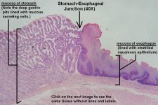 Stomach – Tutorial – Histology Atlas for Anatomy and Physiology