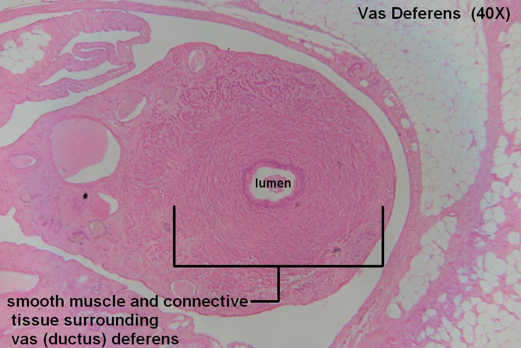 vas-deferens-histology-labeled