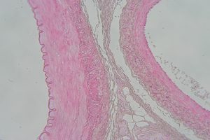 Unlabeled Blood Vessel Images – Histology Atlas for Anatomy and Physiology