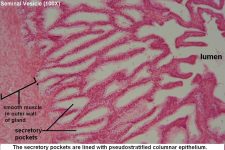 Seminal Vesicles – Tutorial – Histology Atlas for Anatomy and Physiology