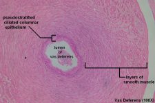 Vas Deferens Tutorial Histology Atlas For Anatomy And Physiology