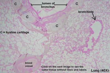 Bronchi and Bronchioles – Tutorial – Histology Atlas for Anatomy and ...