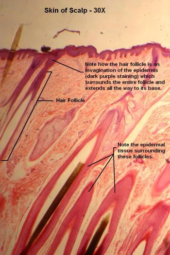 Skin of Scalp – Tutorial – Histology Atlas for Anatomy and Physiology