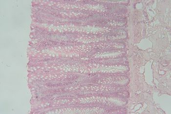 Unlabeled Digestive System Images – Histology Atlas for Anatomy and ...