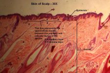 Skin of Scalp – Tutorial – Histology Atlas for Anatomy and Physiology