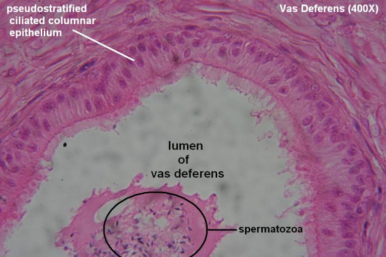 Vas Deferens – Tutorial – Histology Atlas For Anatomy And Physiology