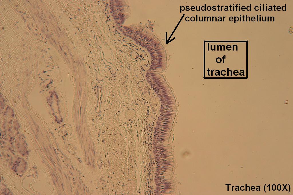 Trachea – Tutorial – Histology Atlas for Anatomy and Physiology