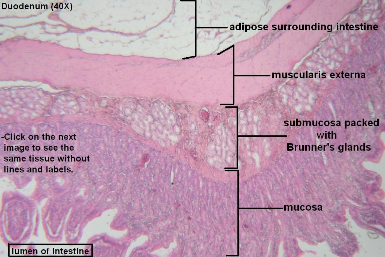 Small Intestine – Tutorial – Histology Atlas for Anatomy and Physiology