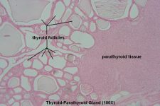 Thyroid-Parathyroid – Tutorial – Histology Atlas for Anatomy and Physiology