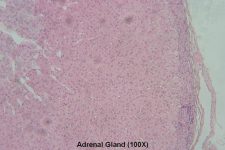 Adrenal Gland – Tutorial – Histology Atlas for Anatomy and Physiology