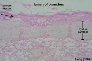 Bronchi and Bronchioles – Tutorial – Histology Atlas for Anatomy and ...