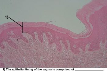 Quiz – Female Reproductive System – Histology Atlas for Anatomy and ...