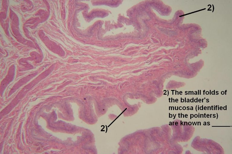 Quiz Urinary System Histology Atlas for Anatomy and Physiology