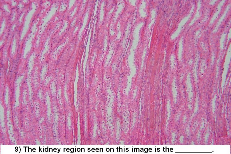 Quiz Urinary System Histology Atlas for Anatomy and Physiology