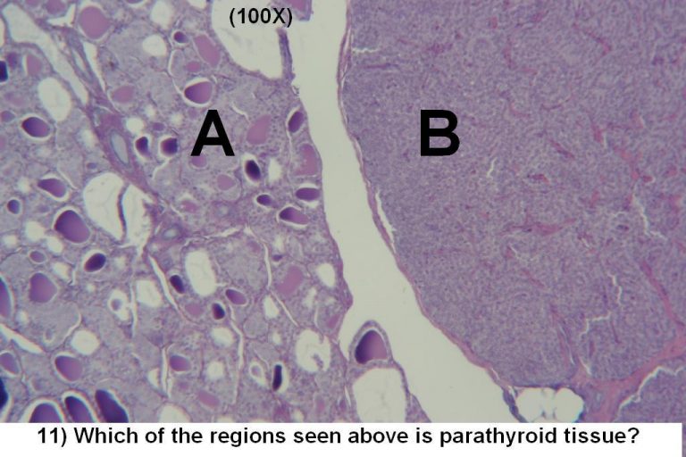 Quiz – Endocrine System – Histology Atlas for Anatomy and Physiology