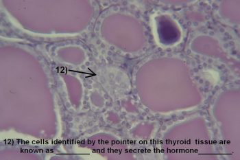 Quiz – Endocrine System – Histology Atlas for Anatomy and Physiology