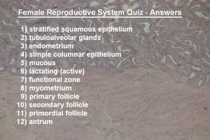 Quiz – Female Reproductive System – Histology Atlas for Anatomy and