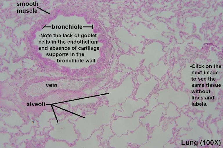 Bronchi and Bronchioles – Tutorial – Histology Atlas for Anatomy and ...