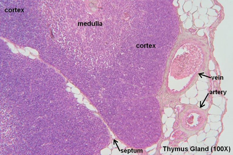 Thymus Tutorial Histology Atlas for Anatomy and Physiology