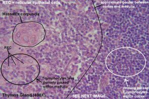 Thymus – Tutorial – Histology Atlas for Anatomy and Physiology