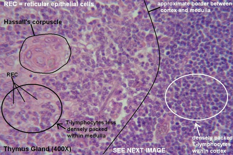 Thymus – Tutorial – Histology Atlas for Anatomy and Physiology