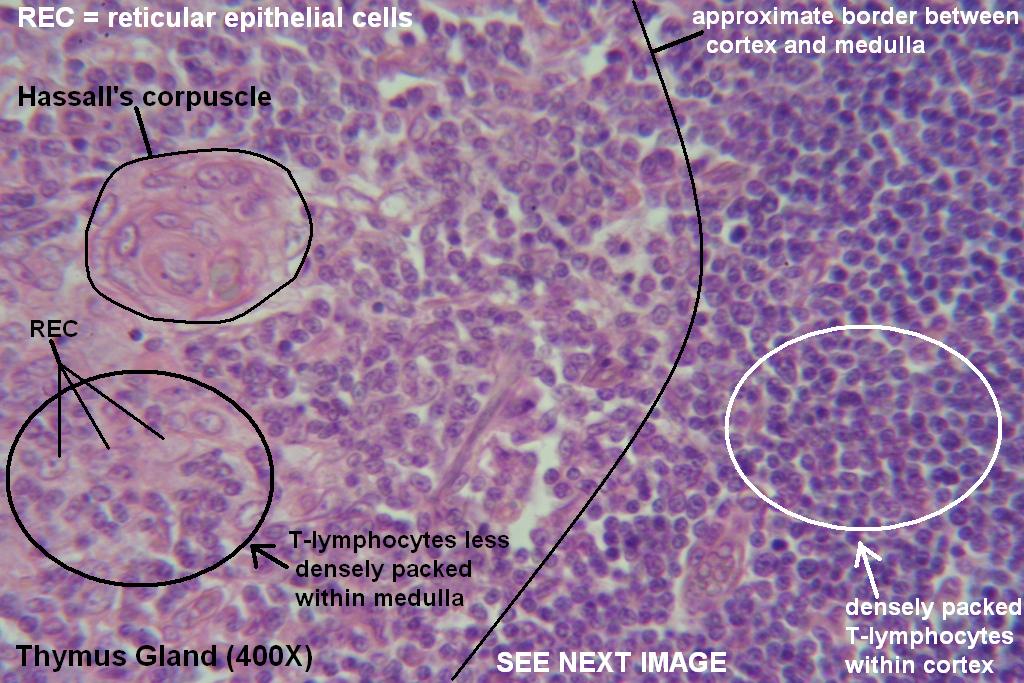 Thymus Tutorial Histology Atlas For Anatomy And Physiology