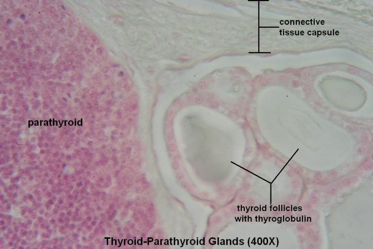 Thyroid-Parathyroid – Tutorial – Histology Atlas for Anatomy and Physiology