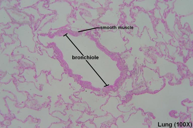 Bronchi and Bronchioles – Tutorial – Histology Atlas for Anatomy and ...