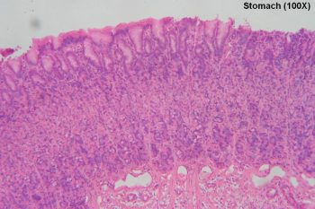 Stomach – Tutorial – Histology Atlas for Anatomy and Physiology