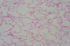 Unlabeled Respiratory Tissues – Histology Atlas for Anatomy and Physiology