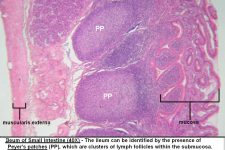 Small Intestine – Tutorial – Histology Atlas for Anatomy and Physiology