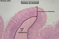 Large Intestine – Tutorial – Histology Atlas for Anatomy and Physiology