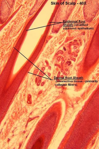 Skin of Scalp – Tutorial – Histology Atlas for Anatomy and Physiology